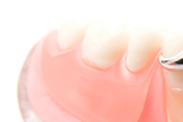 歯を失った場合の治療